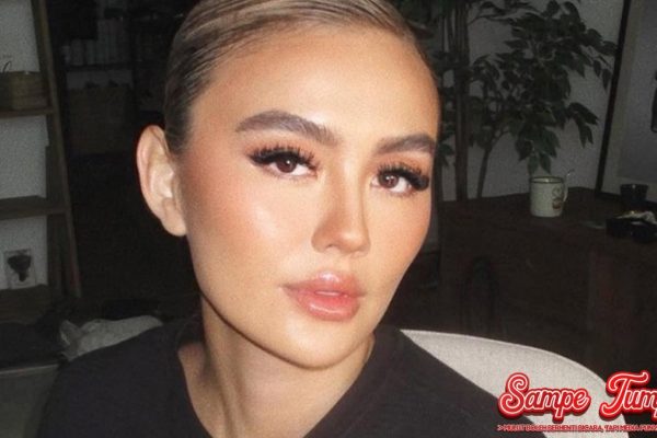 Alopecia Areata: Mengapa Agnez Mo Takutkan Kerontokan? Alopecia Areata: Mengapa Agnez Mo Takutkan Kerontokan?