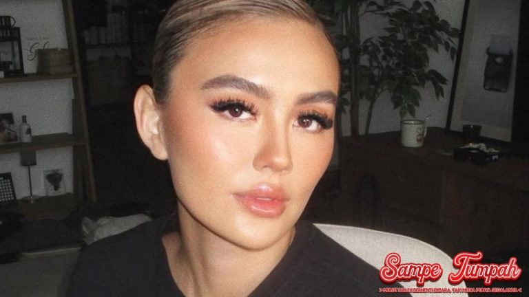Alopecia Areata: Mengapa Agnez Mo Takutkan Kerontokan?