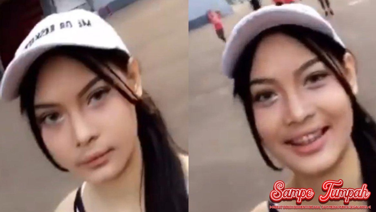 Erika Carlina Tampil Beda Usai Jujur Soal Oplas Hidung-Bibir