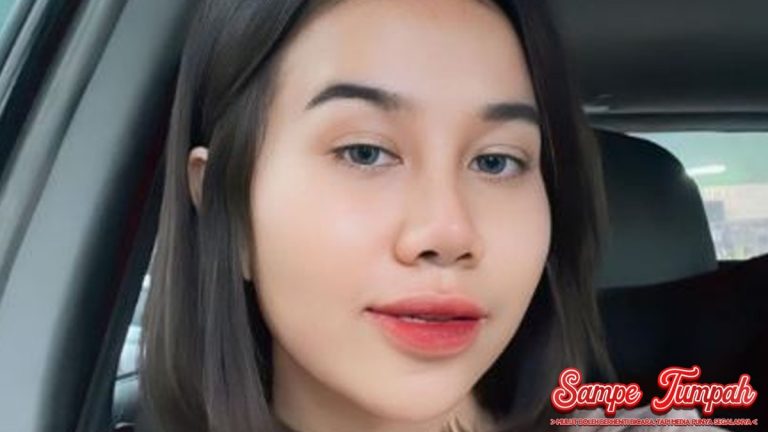 Rp20 Juta Sekali Perawatan, Kulit Glowing Mayang Lucyana