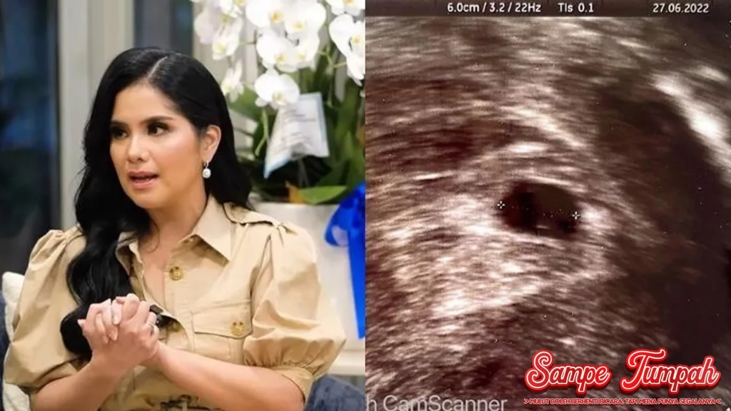 Annisa Pohan Hamil? Ini 2 Jawaban baru Keluarga Bakrie! 4 Annisa Pohan Hamil? Ini 2 Jawaban baru Keluarga Bakrie!