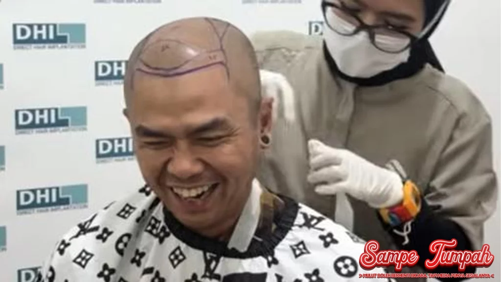 Wendi Cagur Percaya Diri dalam 5000 Helai Rambut