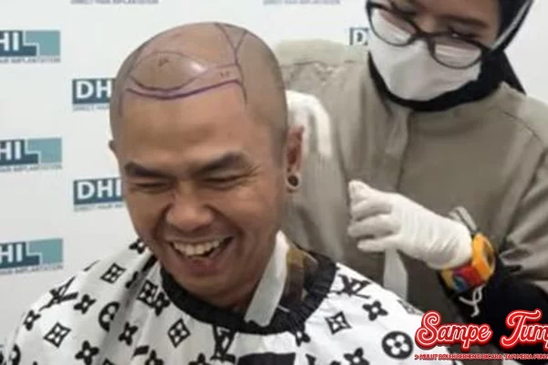 Wendi Cagur Percaya Diri dalam 5000 Helai Rambut