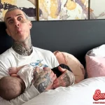 Travis Barker Bangkit? Kisah Lawan 1 Trauma Kecelakaan