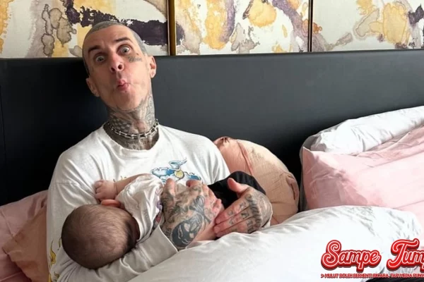 Travis Barker Bangkit? Kisah Lawan 1 Trauma Kecelakaan