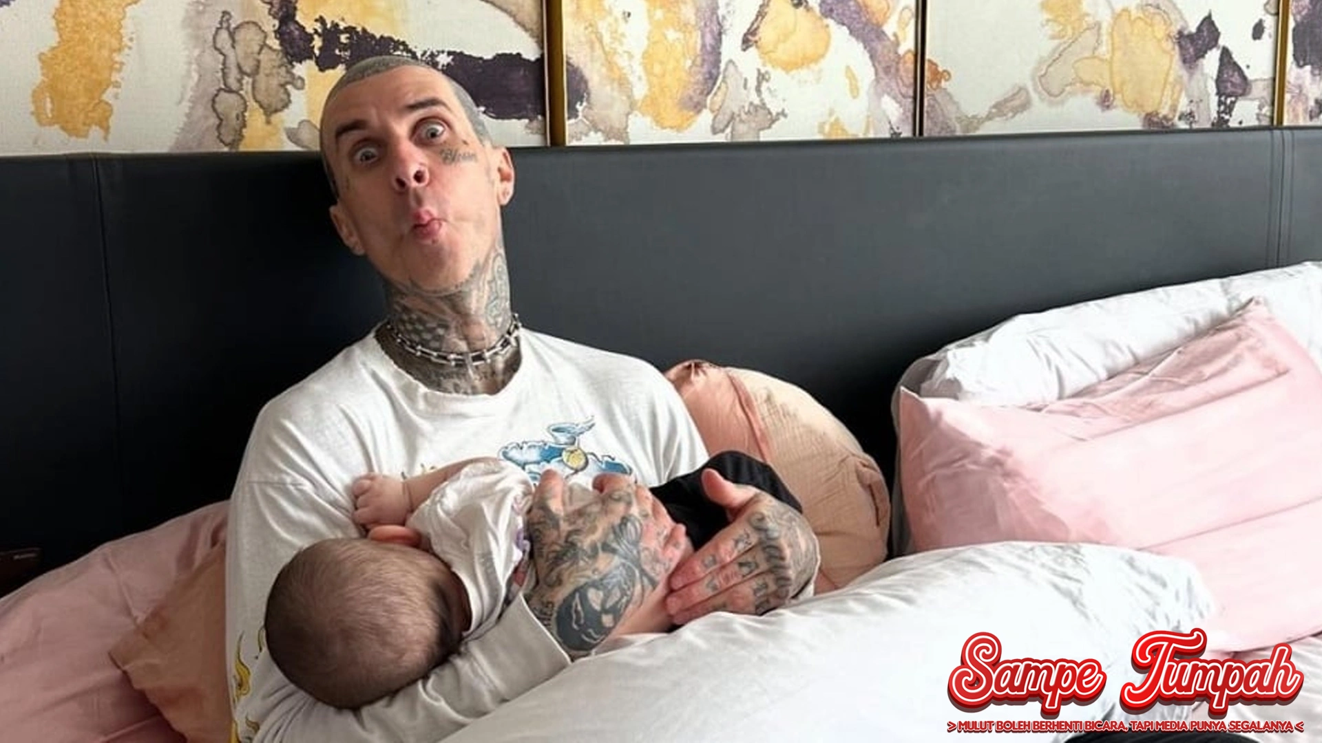 Travis Barker Bangkit? Kisah Lawan 1 Trauma Kecelakaan